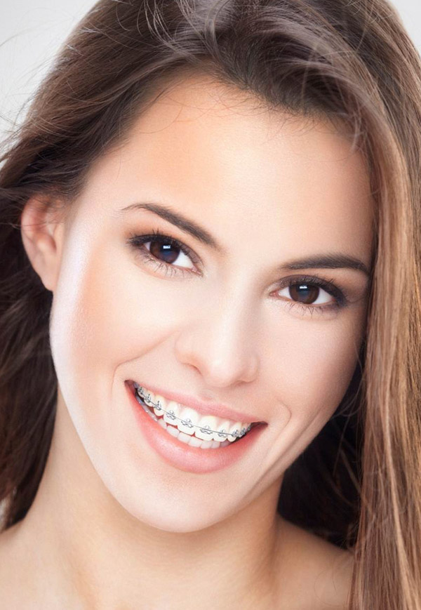 DENTIQ :: Dental Boutique :: Ortodoncia :: Monterrey, México.